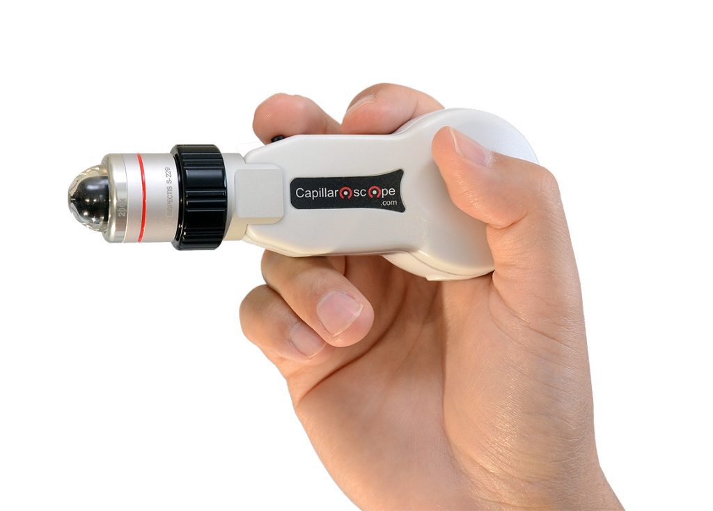 Capillaroscope 200x