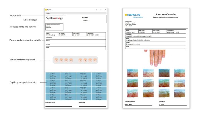 Capillaroscopy-Report