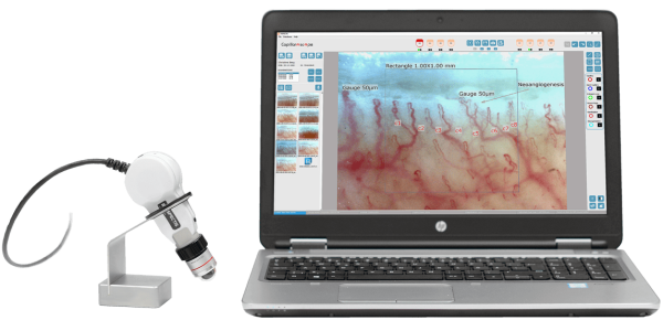 Capillaroscope + software Pro