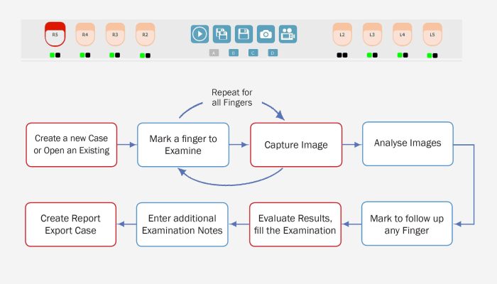 nailfold-video-capillaroscope